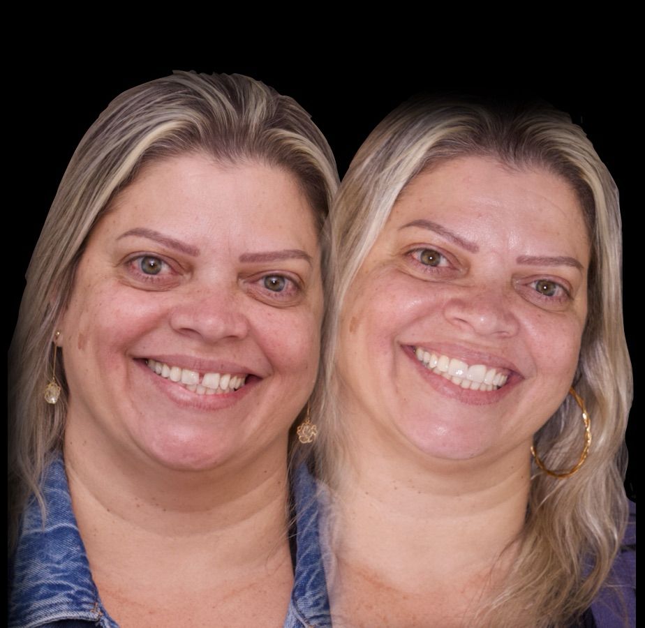 Resultado Dental Concept 6